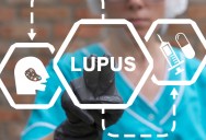 New Scientific Discovery Could Mean A Cure For Lupus