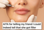 Her Friend Thought Her Lip Filler Was Natural Enough To Go Unnoticed, But Then Got Upset When She Told Her That It Looked Like She Got Work Done