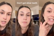 ‘I was one of the silver-teeth kids because my parents never brushed my teeth growing up.’ – Woman Talks About How She Regrets Getting Silver Caps For Her Teeth And How Complicated It Is To Get Them Removed