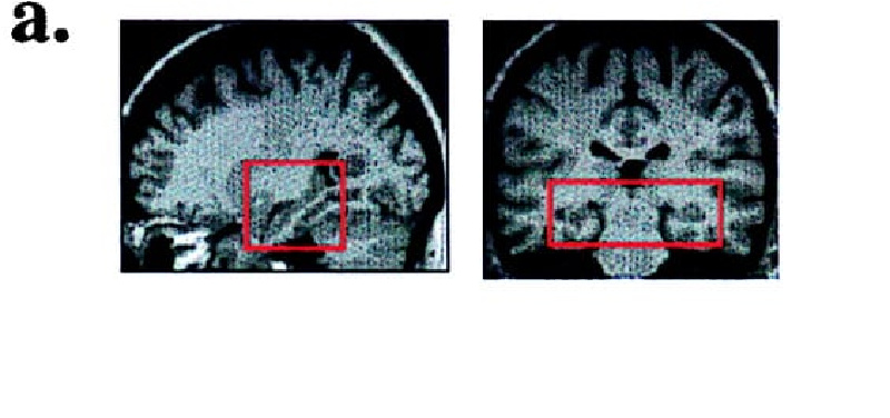 Source: Eleanor A. Maguire, et al