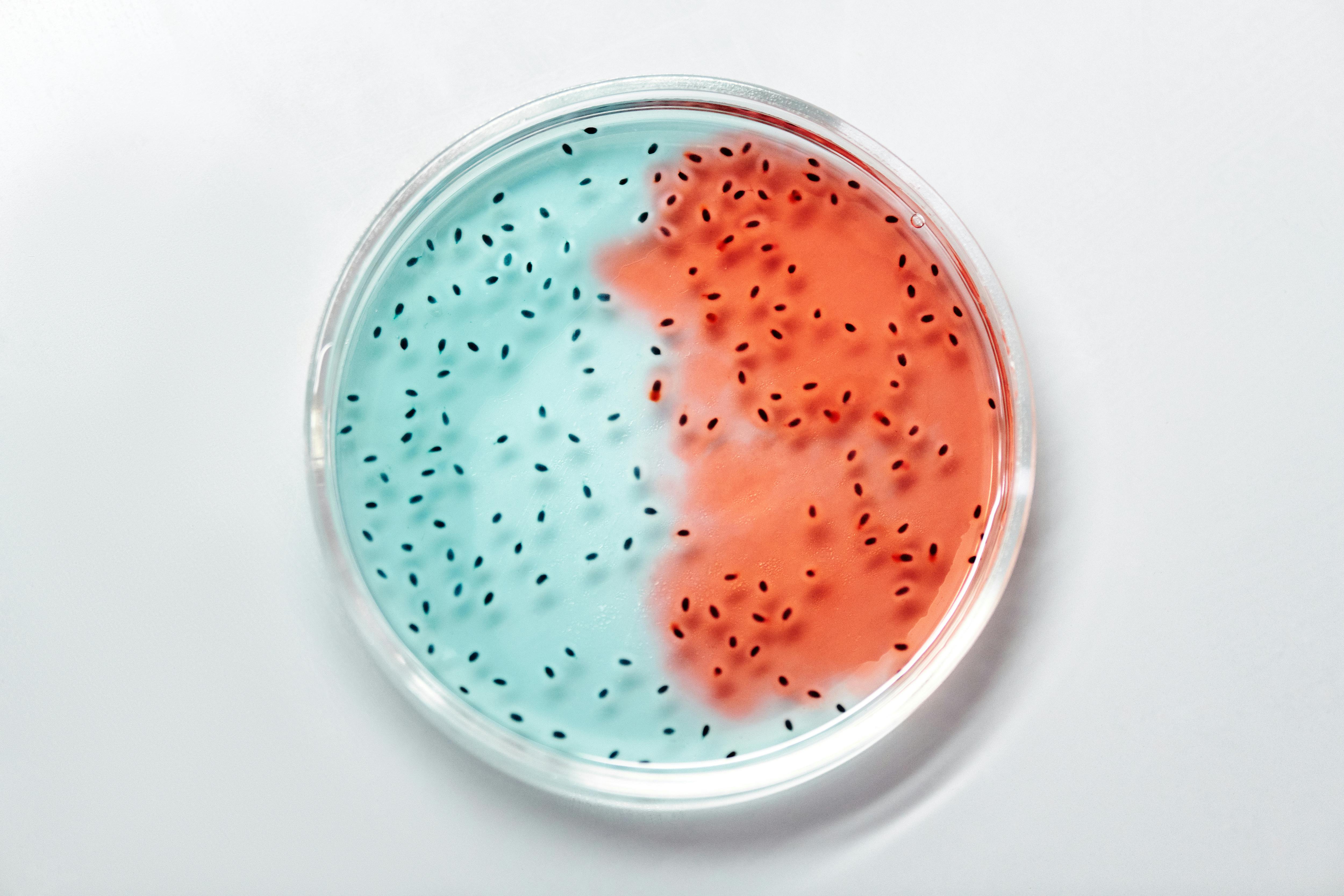 microbes growing in a petri dish