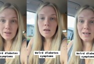 She Lost Her Hair And Had Other Weird Health Symptoms, But When She Went To The Doctor For A Diagnosis She Wasn’t Expecting To Hear She Had Diabetes