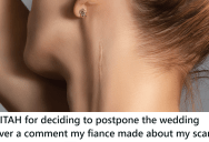 The Scar On Her Neck Had Never Been a Big Problem, But Now It’s Close To Forcing Her To Call Off Her Wedding
