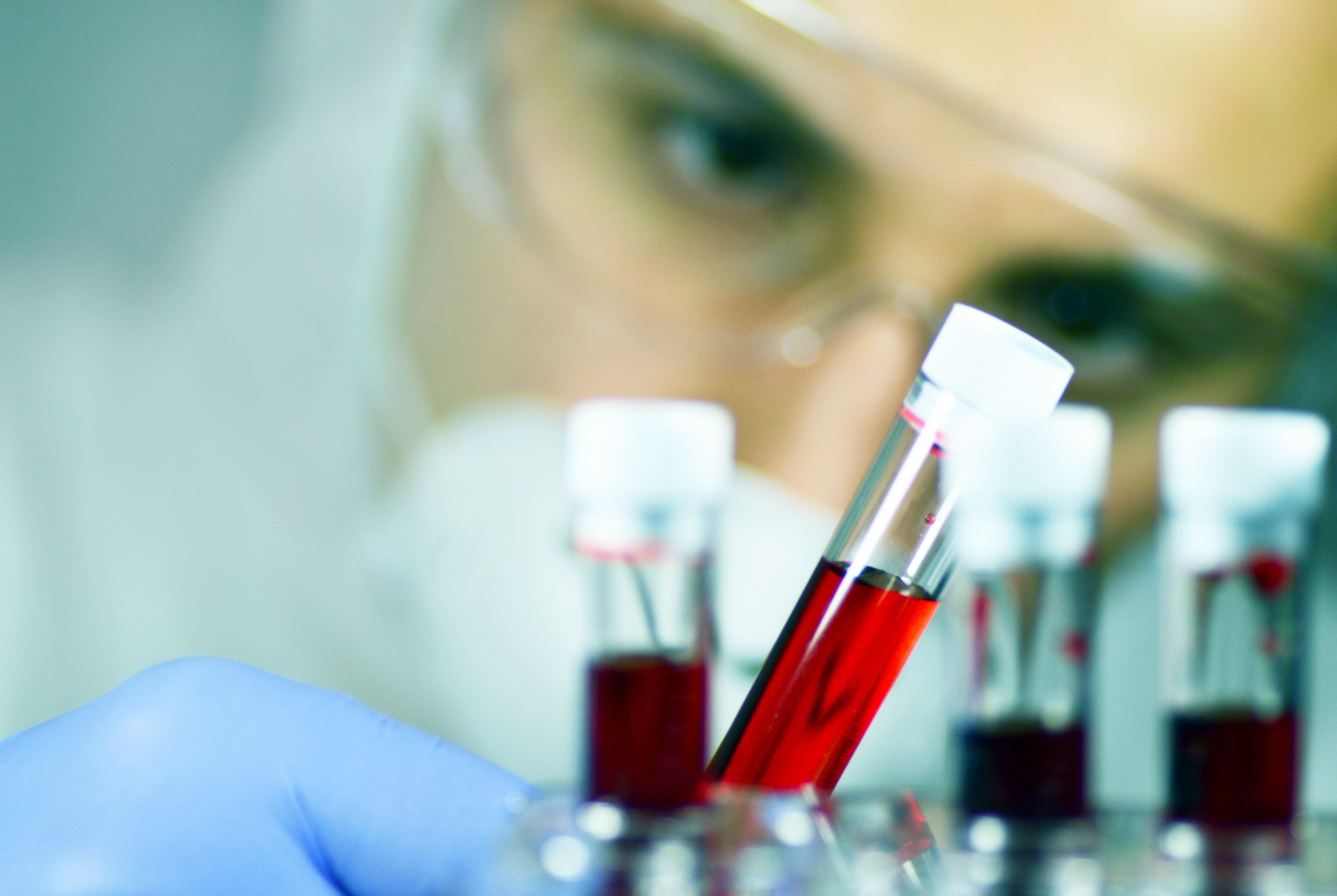 scientists examining blood samples