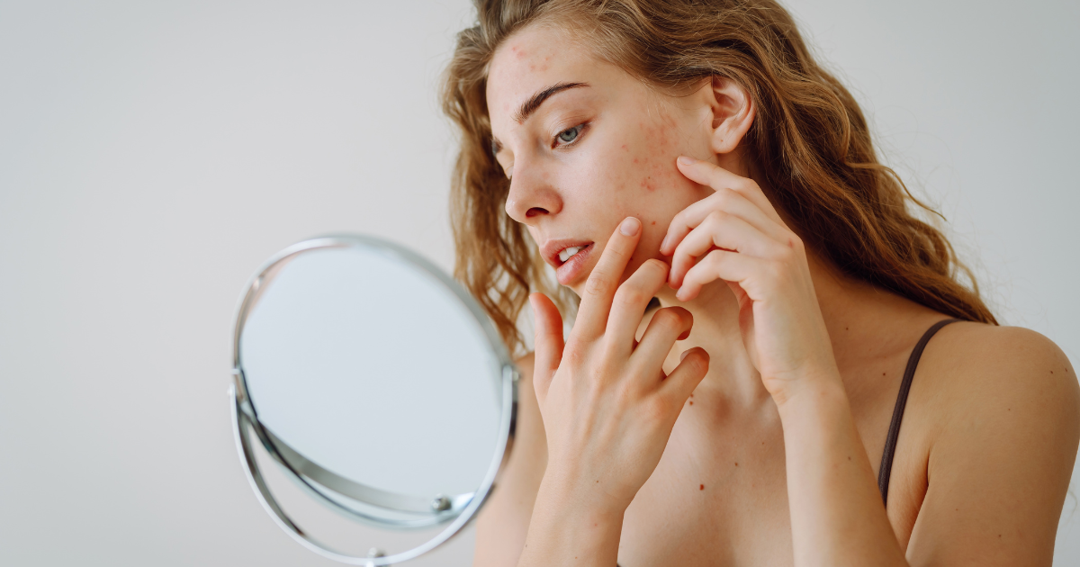 Woman looking at acne in the mirror