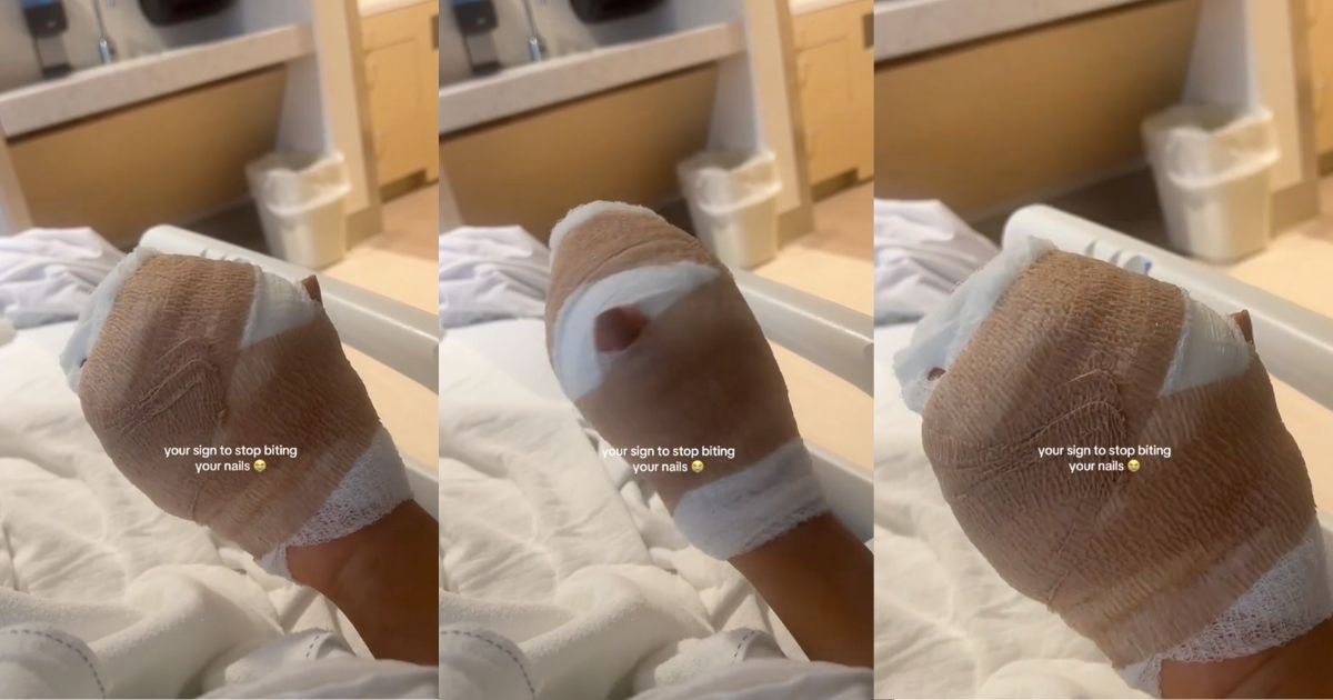 Bandaged hand of woman in hospital