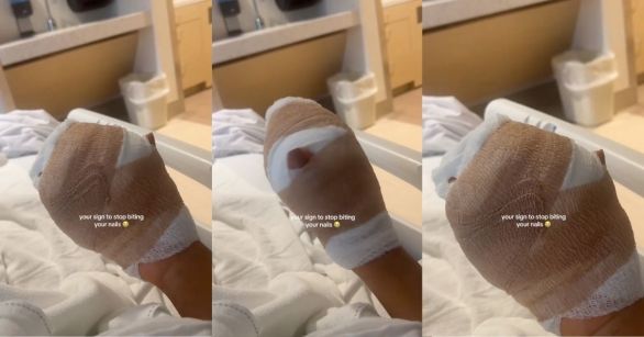 Bandaged hand of woman in hospital