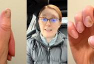 ‘I noticed it starting to pop up on this finger.’ – Nail Salon Customer Warns About The Dangers Of Fungal Infection