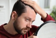 Hair Loss Treatments Are Often Overhyped, So What Methods Actually Work?