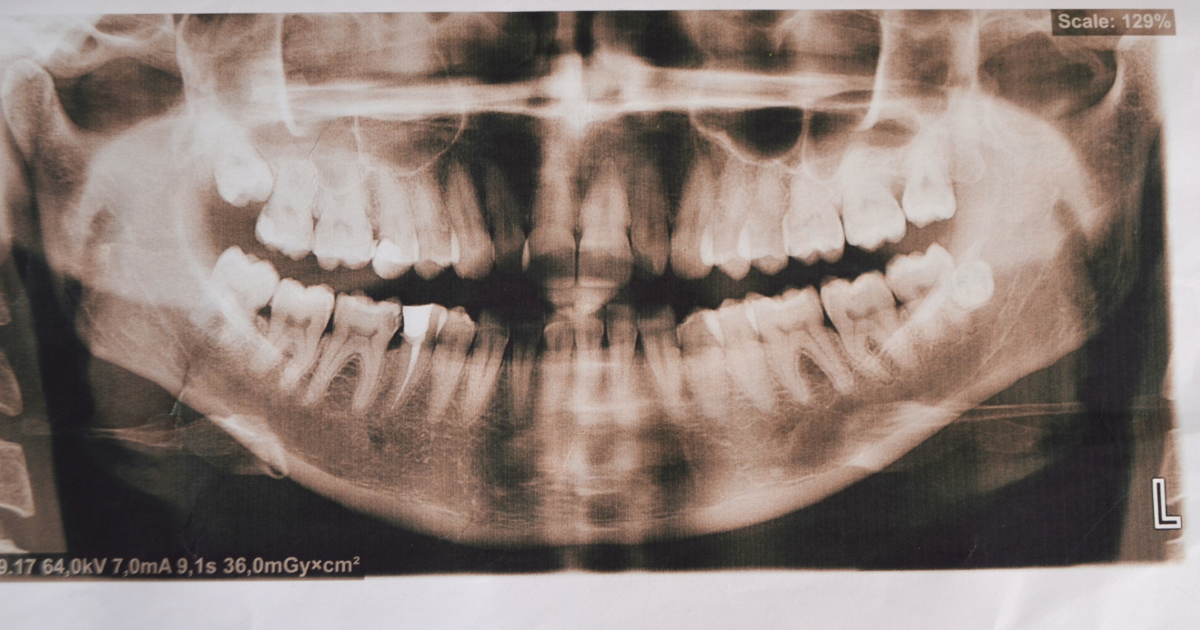 Oral x-ray