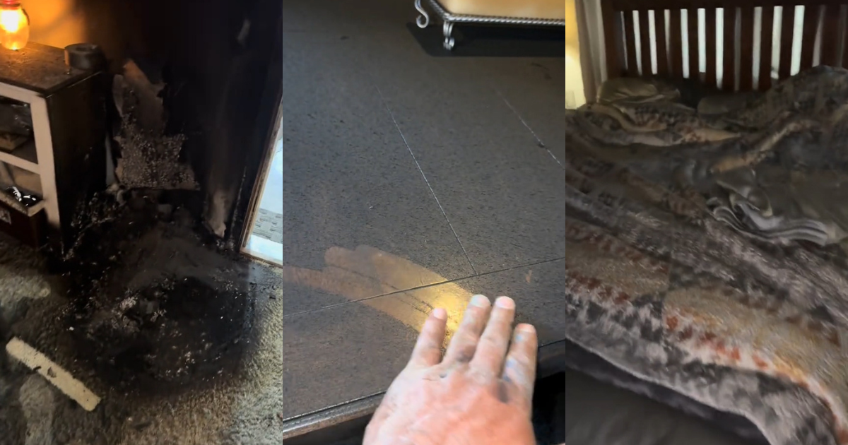 a person showing the aftermath of a lithium ion battery explosion