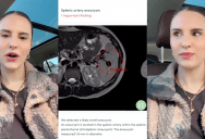 ‘Now I am getting my spleen removed.’ – A Patient Got Some Bad News After She Got A Full Body MRI Scan