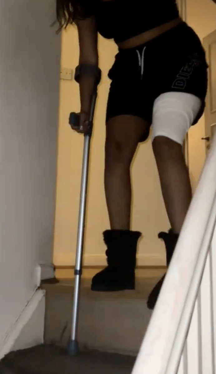 woman wearing a leg bandage