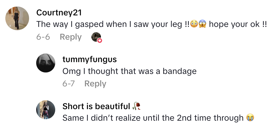 Screenshot 2025 06 18 at 5.45.40 PM “I put it on my leg. Next thing you know, it burst.   She Got Third Degree Burns From A Hot Water Bottle Because Of One Key Mistake