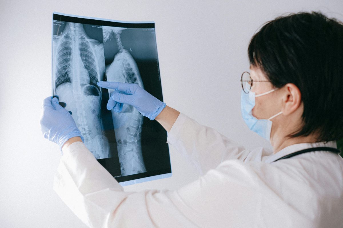 A doctor examining a spine x-ray