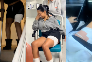 ‘“I put it on my leg. Next thing you know, it burst.’ – She Got Third-Degree Burns From A Hot Water Bottle Because Of One Key Mistake