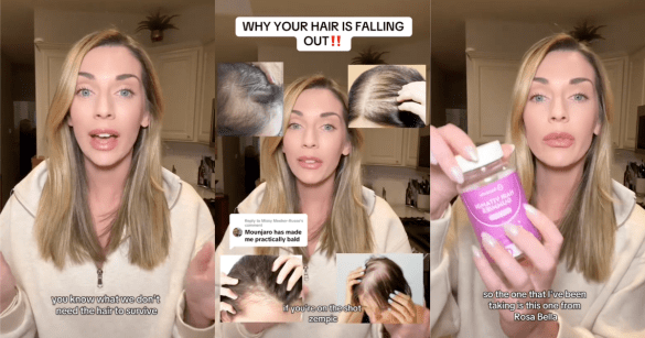 woman talking about hair loss