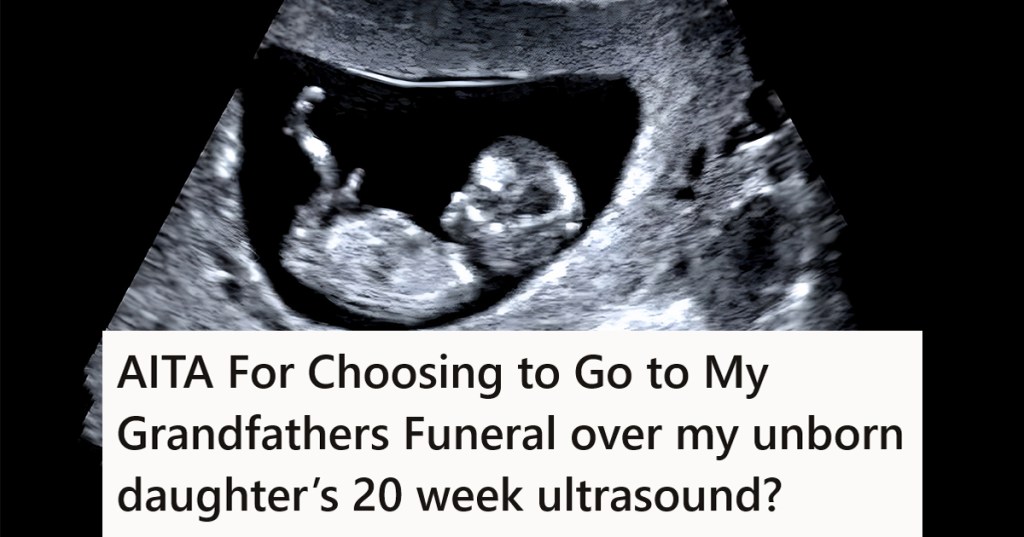 baby on ultrasound photo