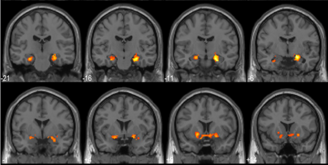 fMRI scans after an epiphany