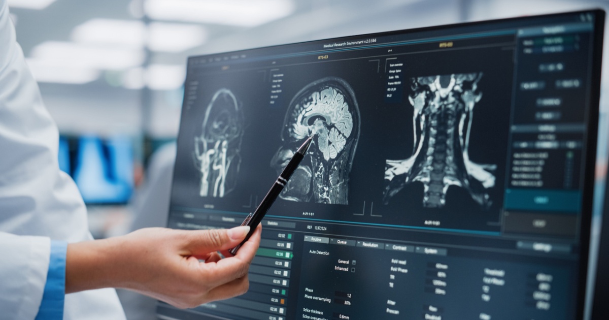 New Study Finds A Method Of Cleaning The Brain That Has Shown Memory Improvements In Mice Doctor pointing at xray of brain