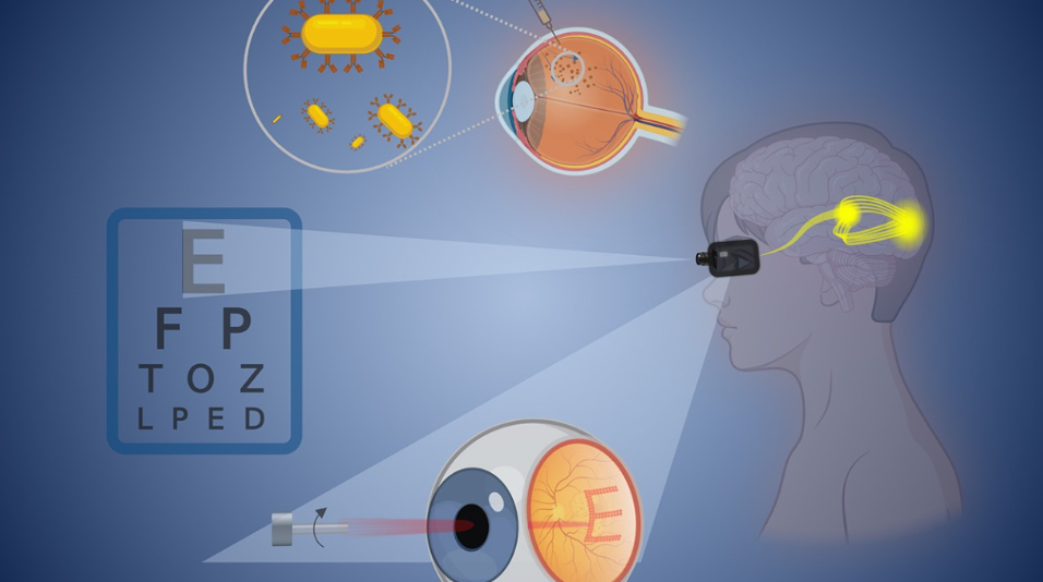 A diagram showing gold nanoparticles restoring vision