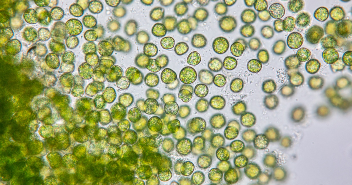 Microscopic plant plankton