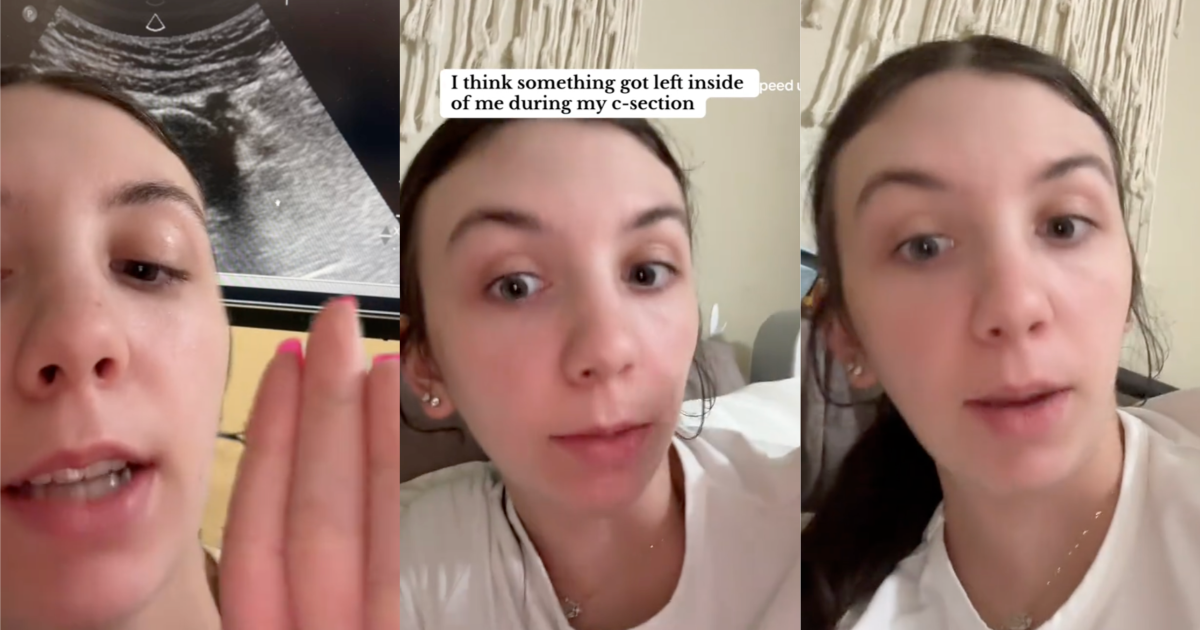 woman talking about her surgery