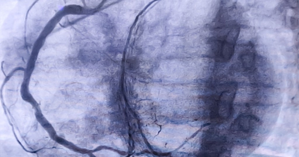 Contrast Dye from an MRI