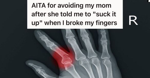 x-ray showing broken finger