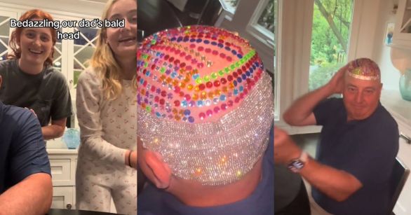Two daughters bedazzling their dad's bald head