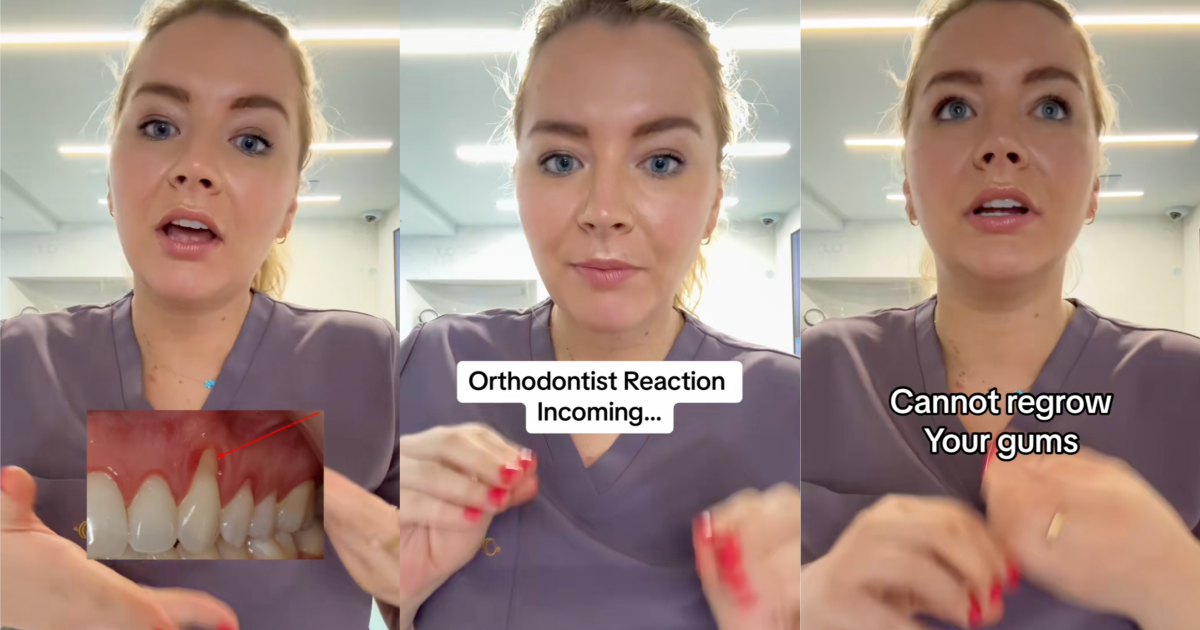 An Orthodontist Talked About How Zyn Can Affect Peoples Gums And Teeth. You do not want to be 40, 50 and have a lot of gum loss. orthodontist talking to viewers