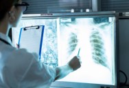 First Ever Gene Edited Pig Lung Transplant Into A Human Offers Valuable Insights