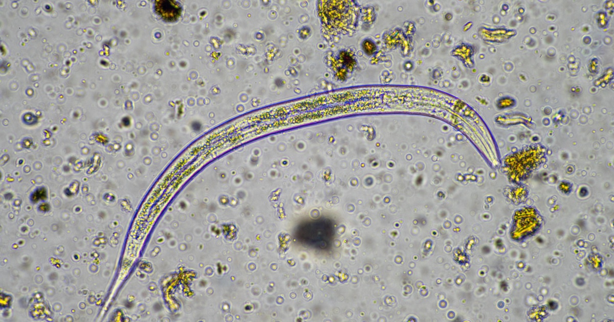 Microscopic microbes