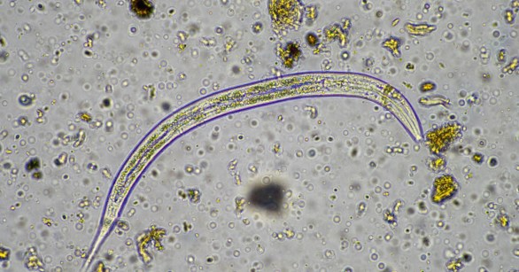Microscopic microbes