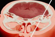 Soviet Physicist Put His Head Into A Particle Accelerator And Got Struck By A Proton Beam Traveling Nearly The Speed Of Light, And Lived To Talk About It