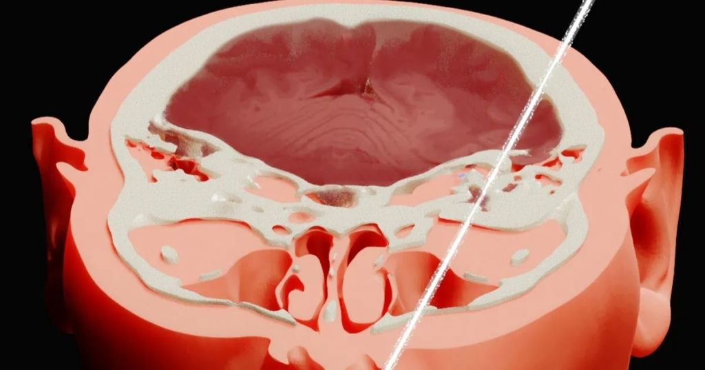 Bugorski's brain 3D representation