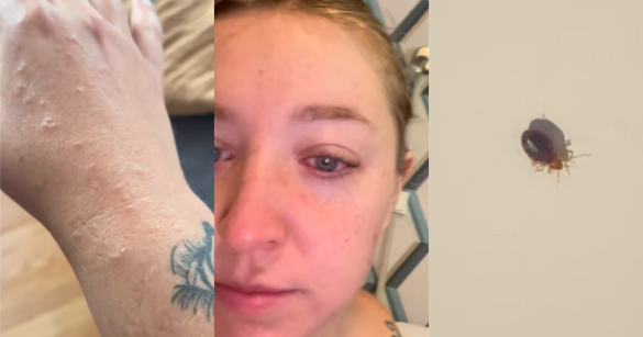 woman talking about bedbugs