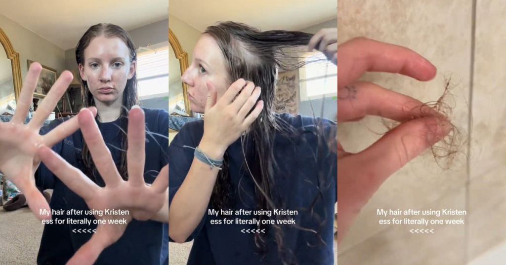 A girl demonstrating her hair loss