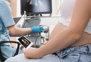 First Ever Time-Lapse Video Of How A Human Embryo Implants Itself Into Uterine Wall Revealed In New Study