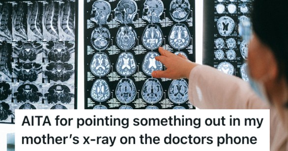 A doctor pointing at an x-ray