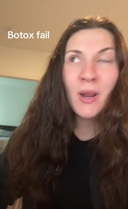 Woman with eye issue