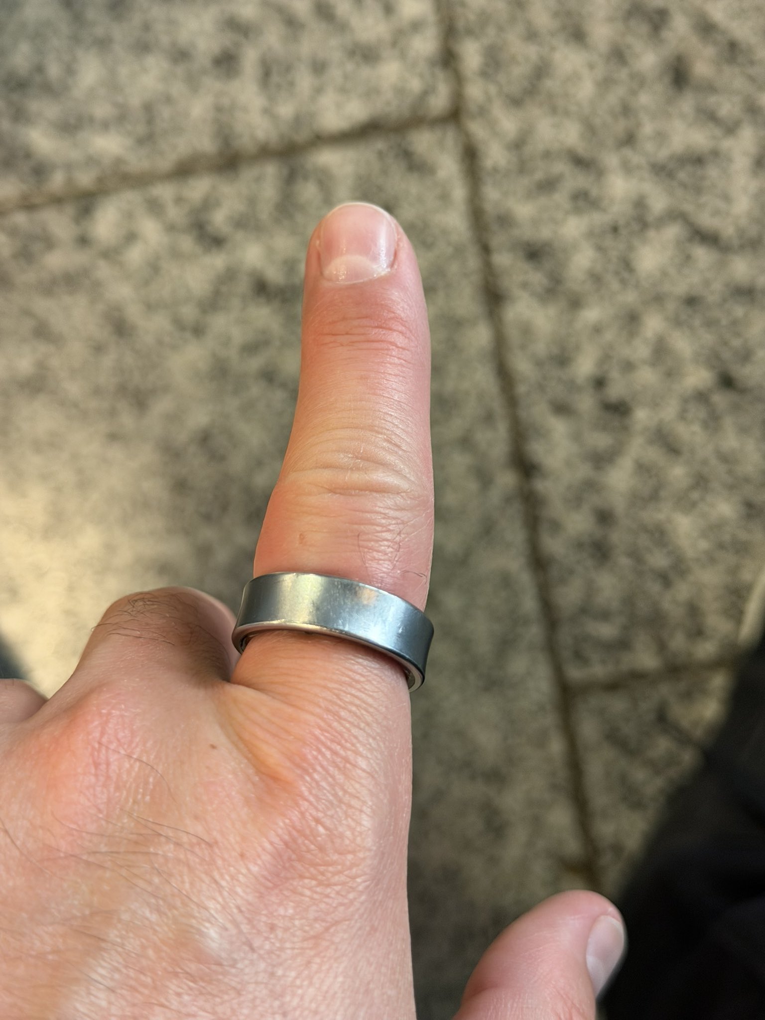 A Samsung ring on a swollen finger