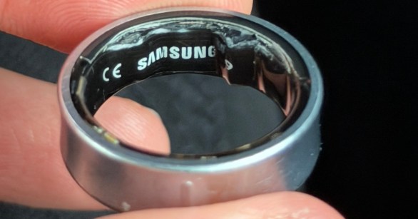 Altman's swollen ring battery