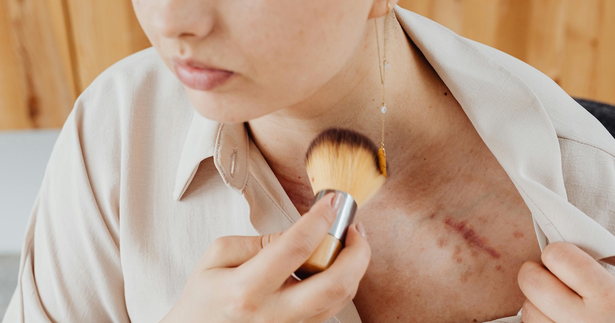 A woman covering up a scar