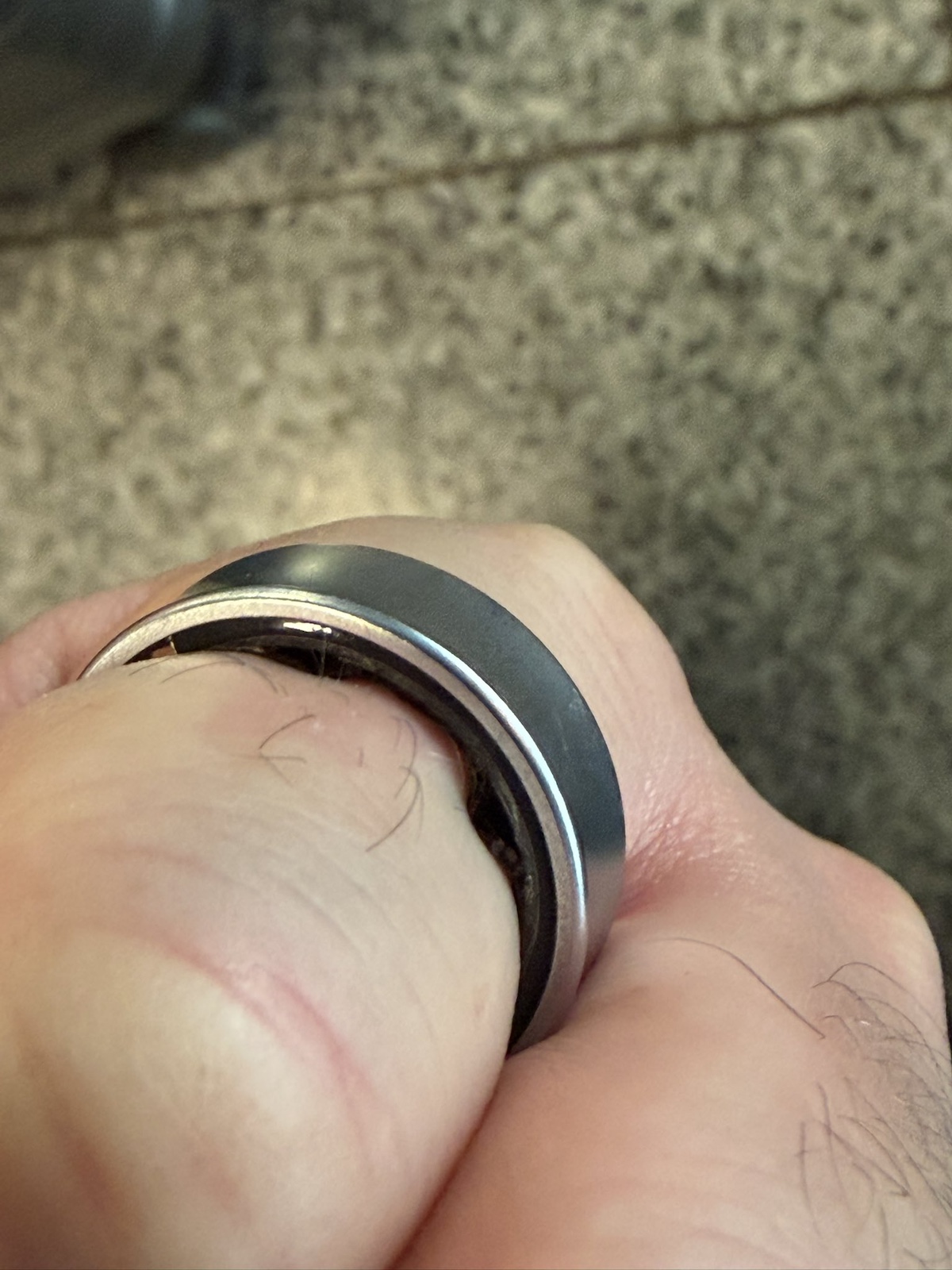 Rotar's swollen ring on his finger