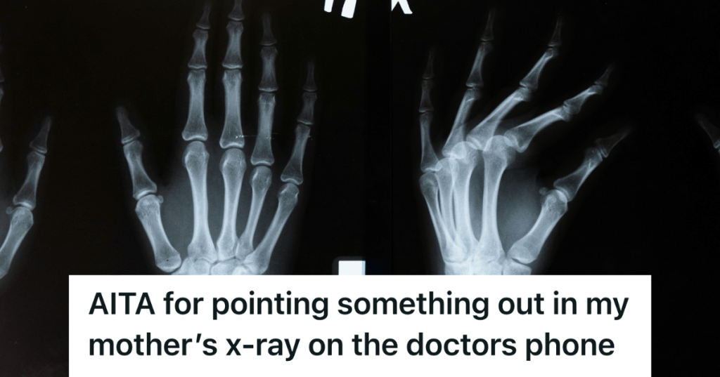 x ray image of hands