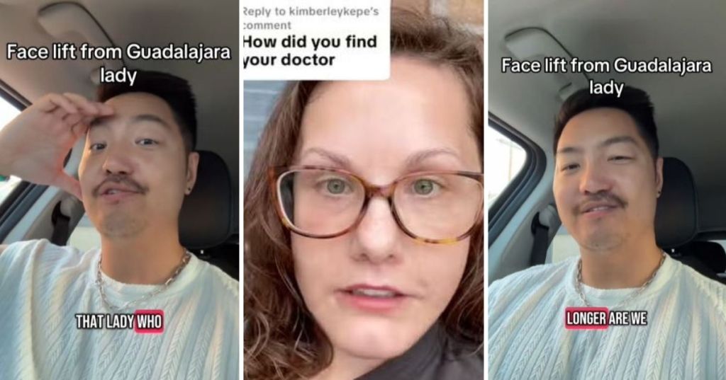 Talking about a facelift