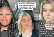 ‘When your chronic illness flare-up won’t calm down.’ – People On TikTok Shared Their Thoughts About “Moon Face”