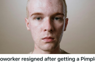 Manufacturing Line Worker Claimed Cleaning Solvents Gave Him A Pimple, So He Walked Away From A Brand New Job