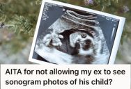 Woman Lost Her Pregnancy While Her Boyfriend Ignored Her Calls From The Hospital, But Now He’s Asking If He Could Look At Their Baby’s Sonogram Pictures